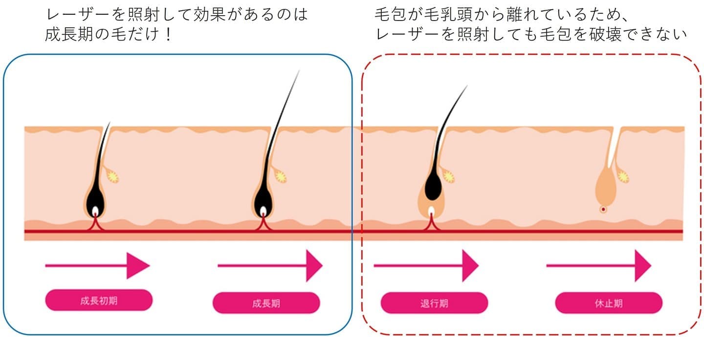 毛周期イラスト